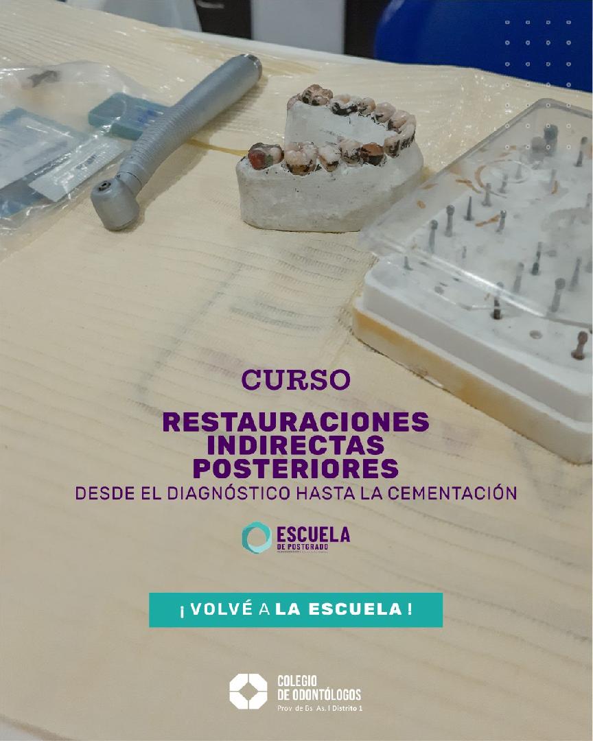 RESTAURACIONES INDIRECTAS POSTERIORES: DESDE EL DIAGNÓSTICO HASTA LA CEMENTACIÓN